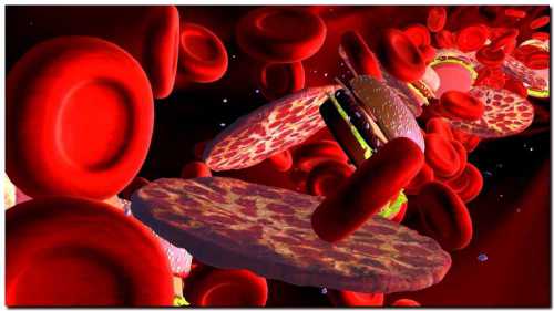 повышенный уровень холестерина в крови: 10 симптомов